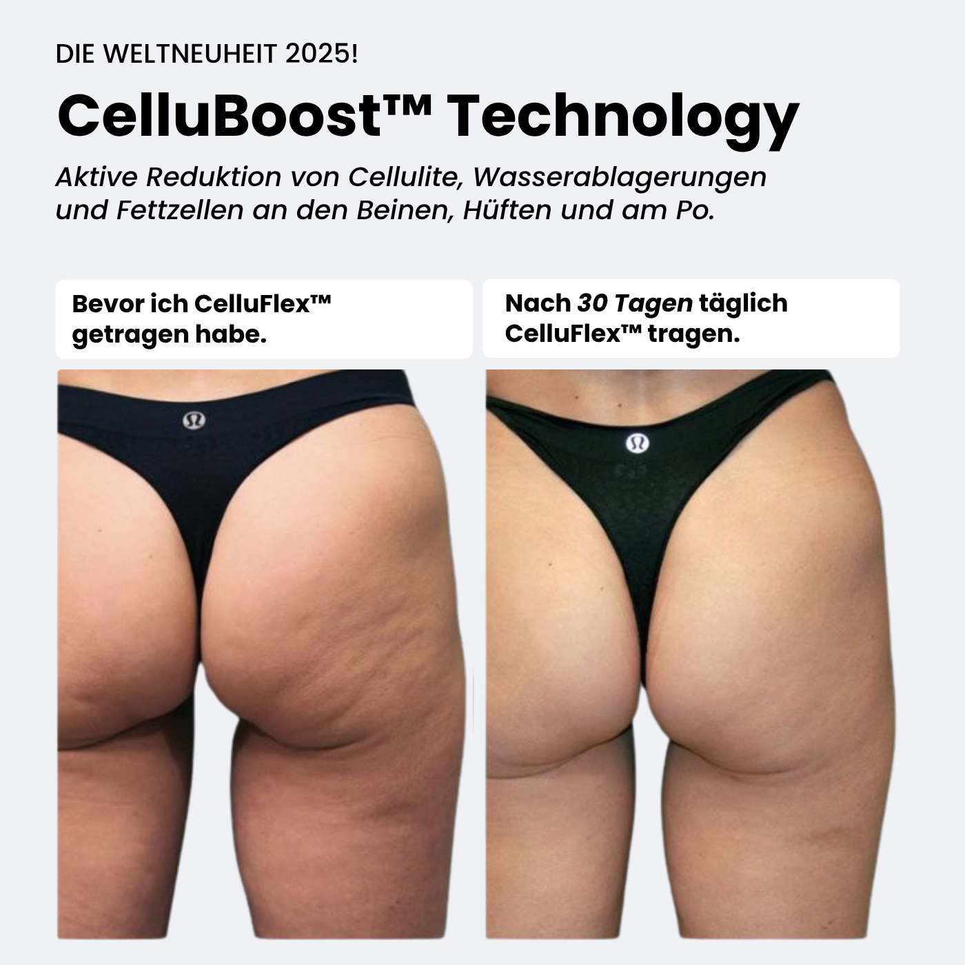 COREEX CelluFlex™ Anti-Cellulite Shorts