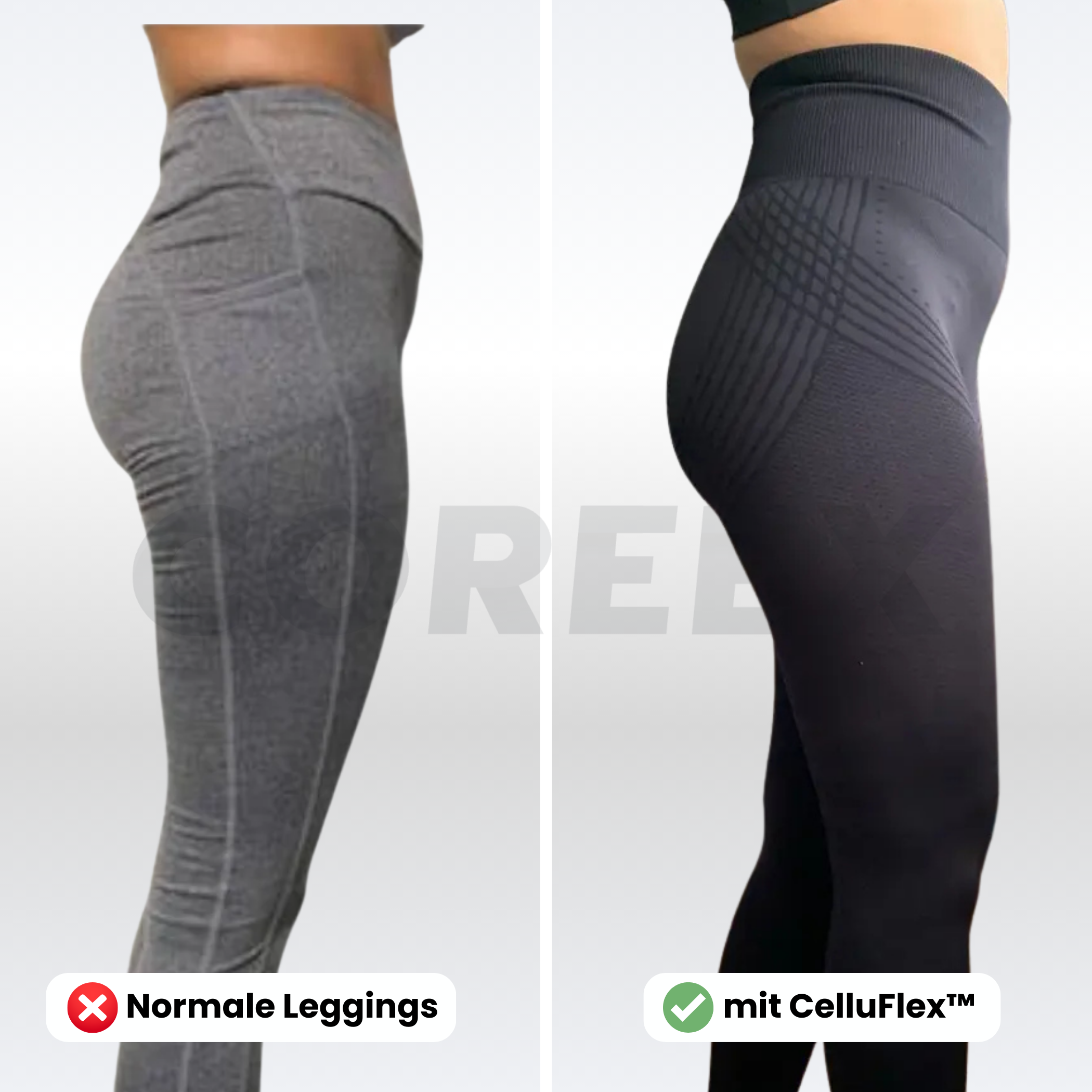 COREEX CelluFlex™ - #1 Anti-Cellulite Leggings