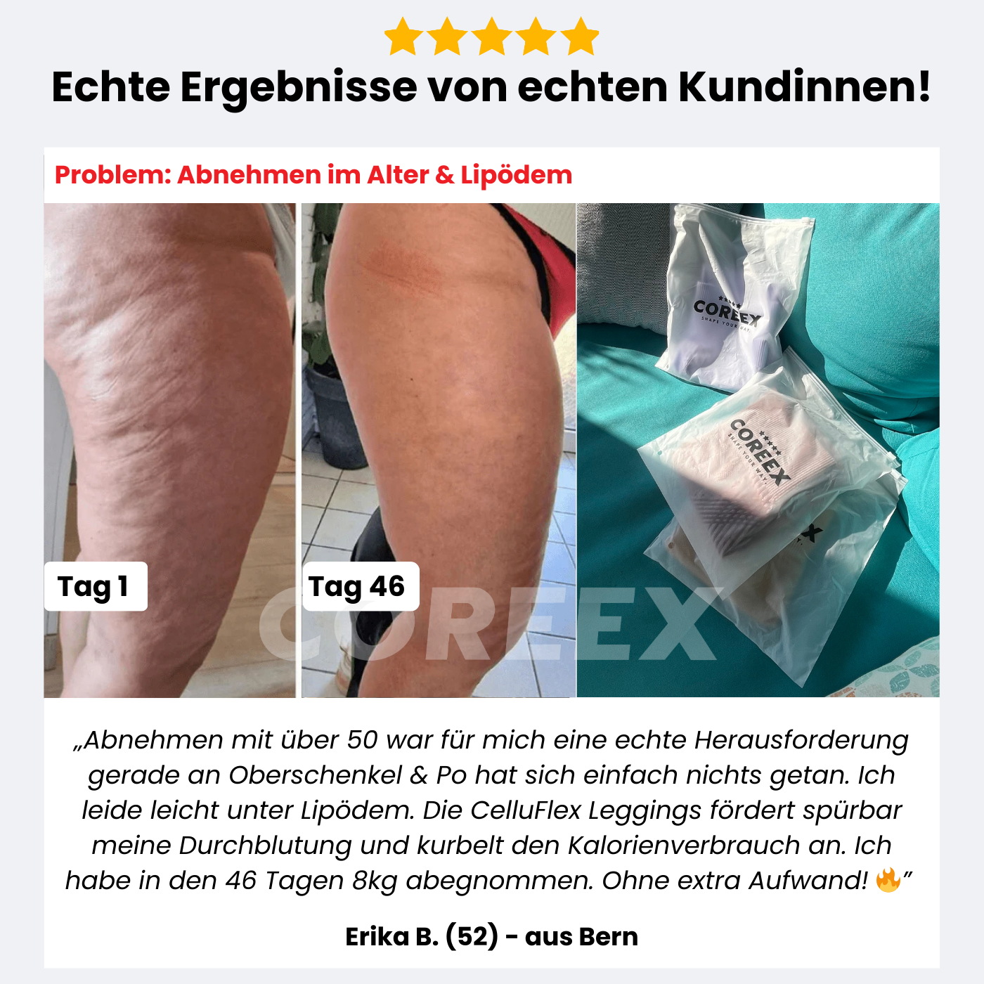 COREEX CelluFlex™ 3D-Kompressionsleggings 1+1 GRATIS