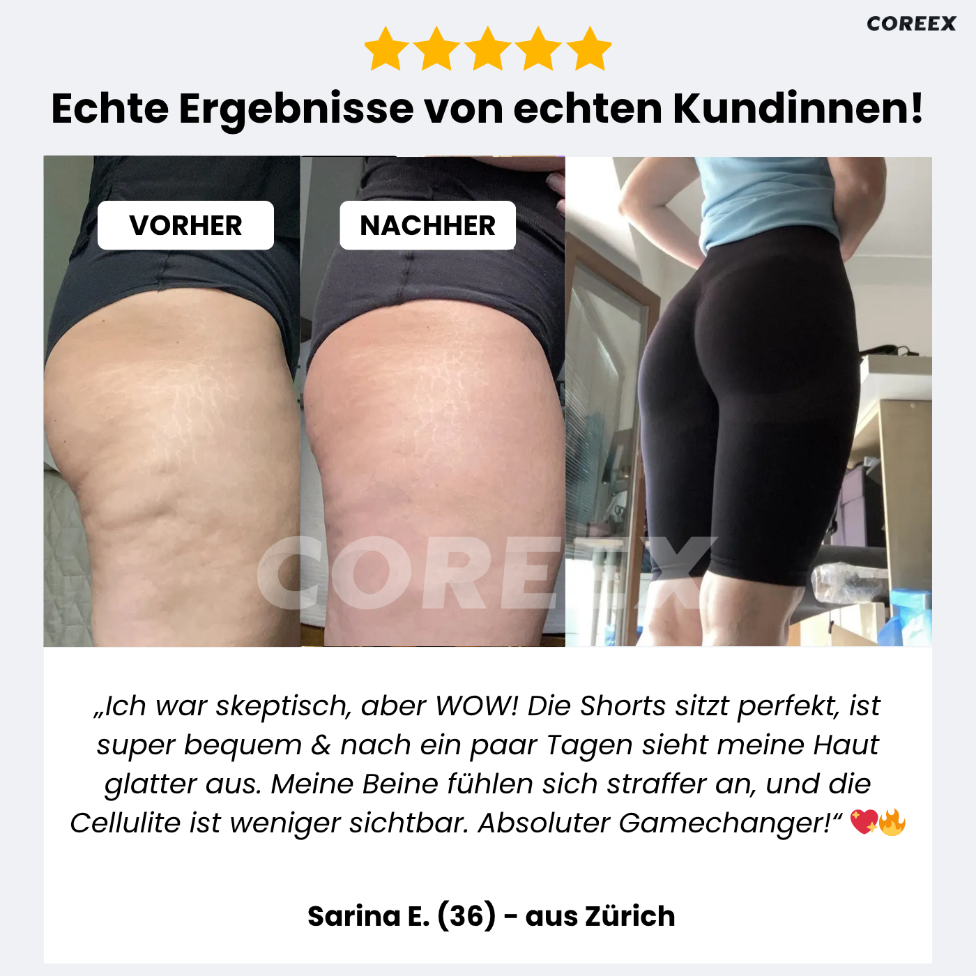 COREEX CelluFlex™ Anti-Cellulite Shorts