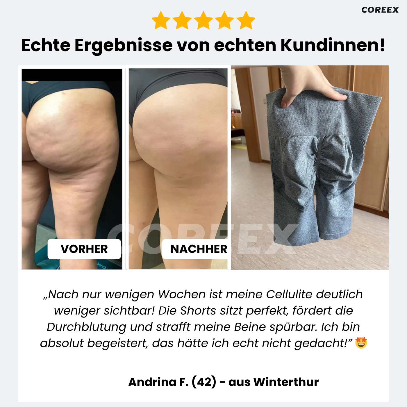 COREEX CelluFlex™ Anti-Cellulite Shorts