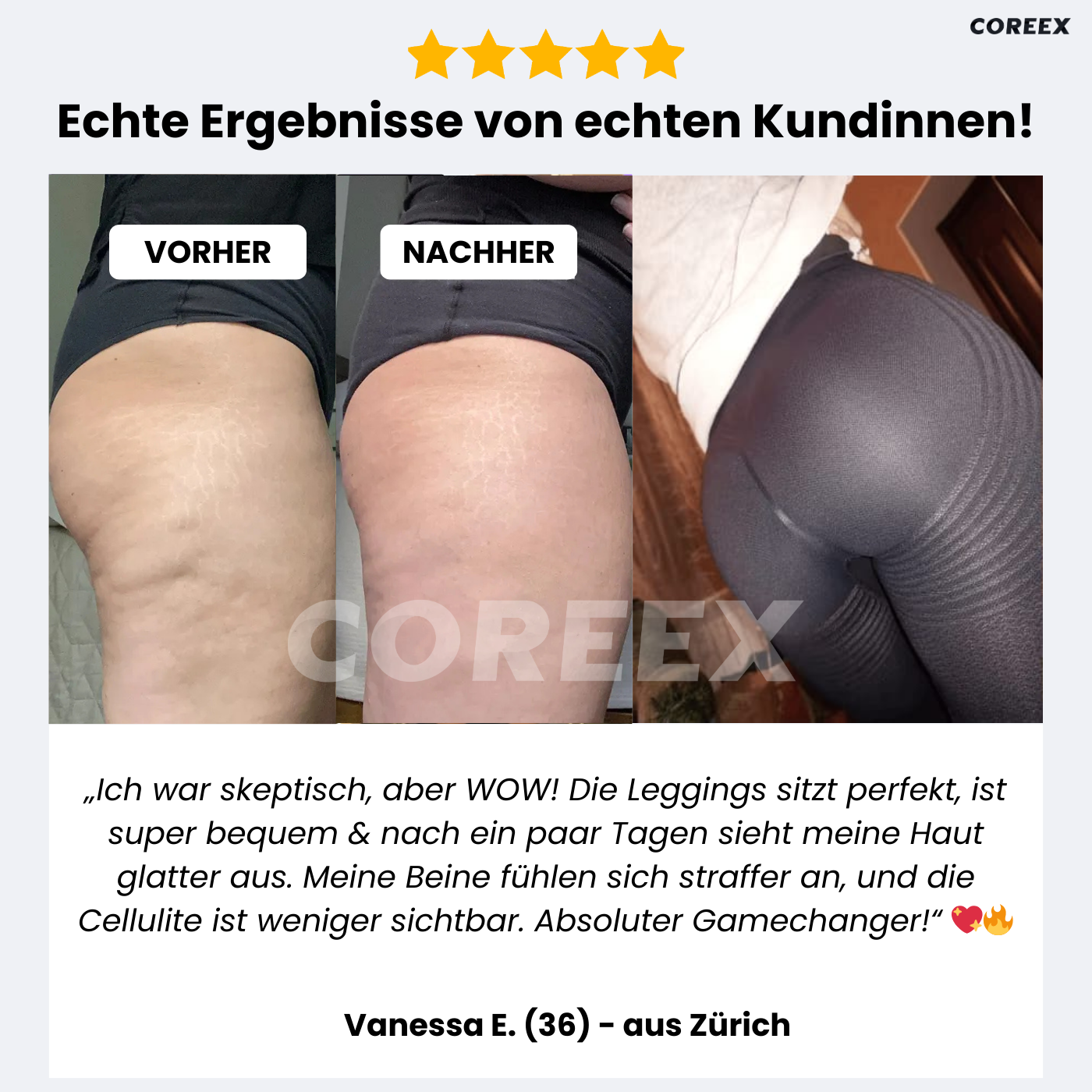 COREEX CelluFlex™ - #1 Anti-Cellulite Leggings