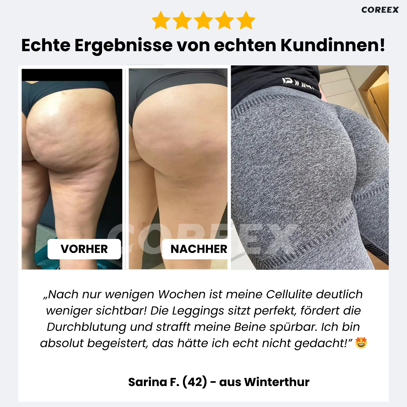 COREEX CelluFlex™ - #1 Anti-Cellulite Leggings