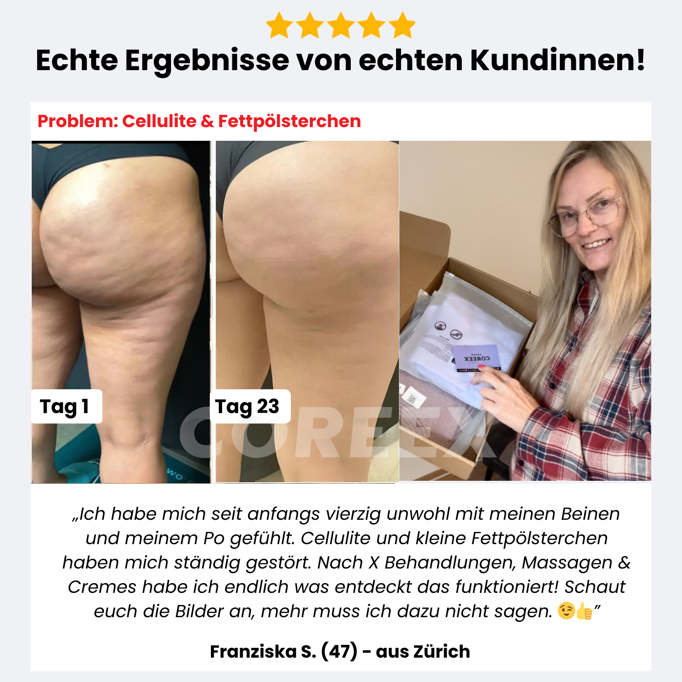 COREEX CelluFlex™ 3D-Kompressionsleggings (Cellulite)