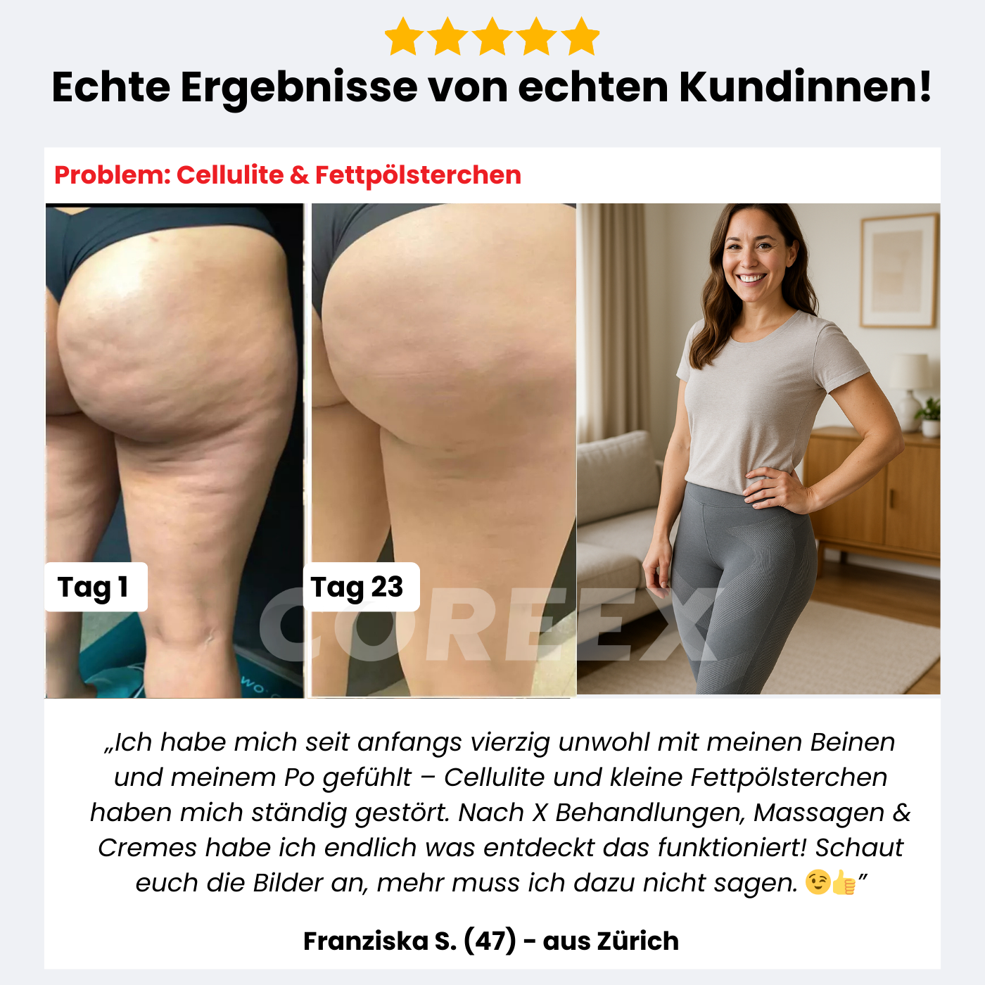 COREEX CelluFlex™ 3D-Kompressionsleggings 1+1 GRATIS