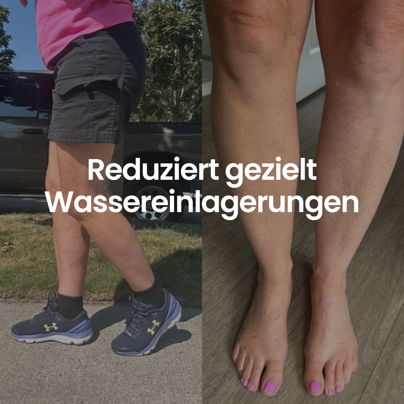 COREEX CelluFlex™ 3D-Kompressionsleggings LIMITED EDITION