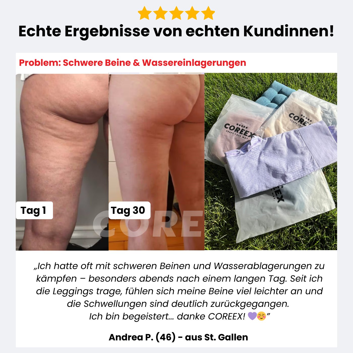 COREEX CelluFlex™ 3D-Kompressionsleggings (schwere Beine)