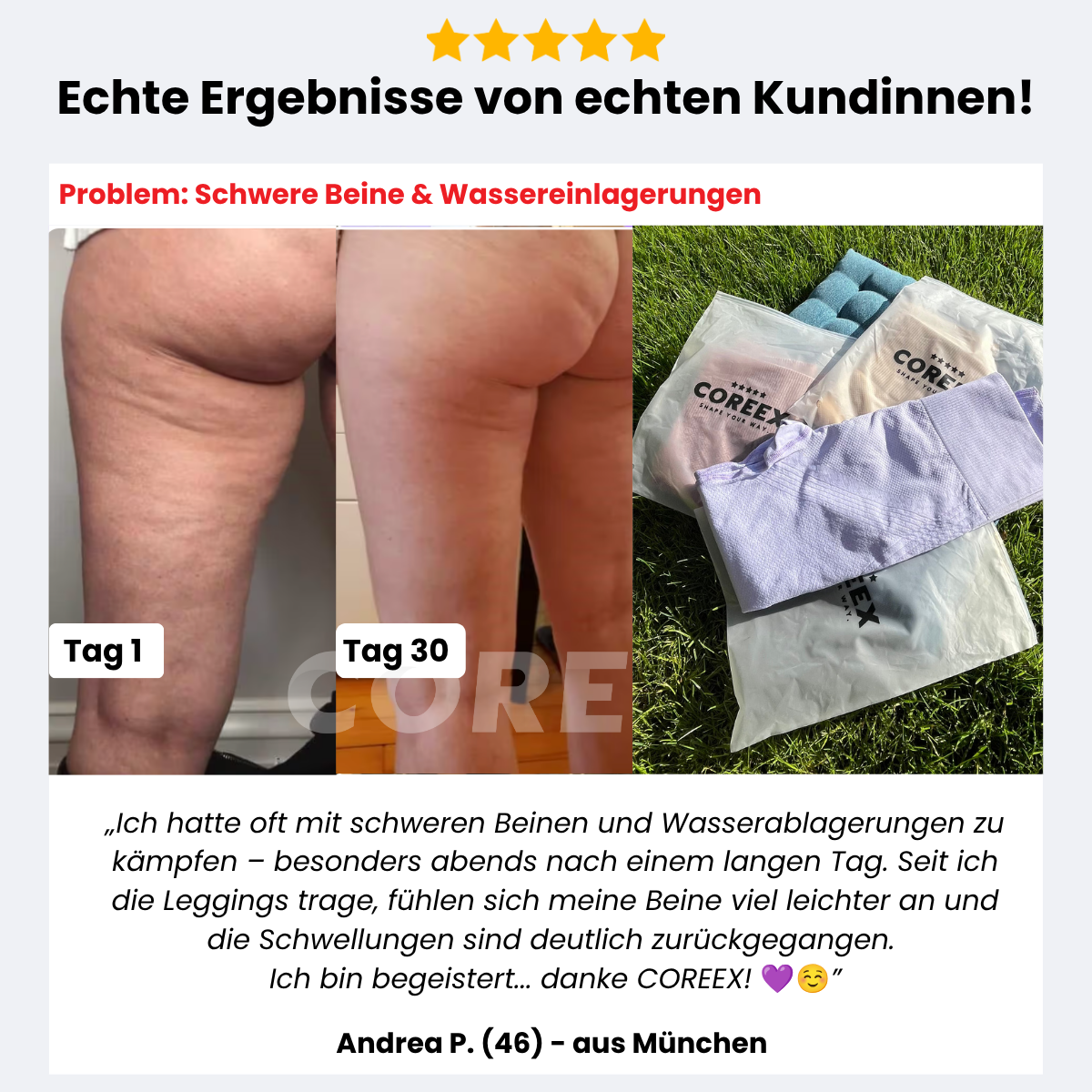 COREEX CelluFlex™ 3D-Kompressionsleggings LIMITED EDITION