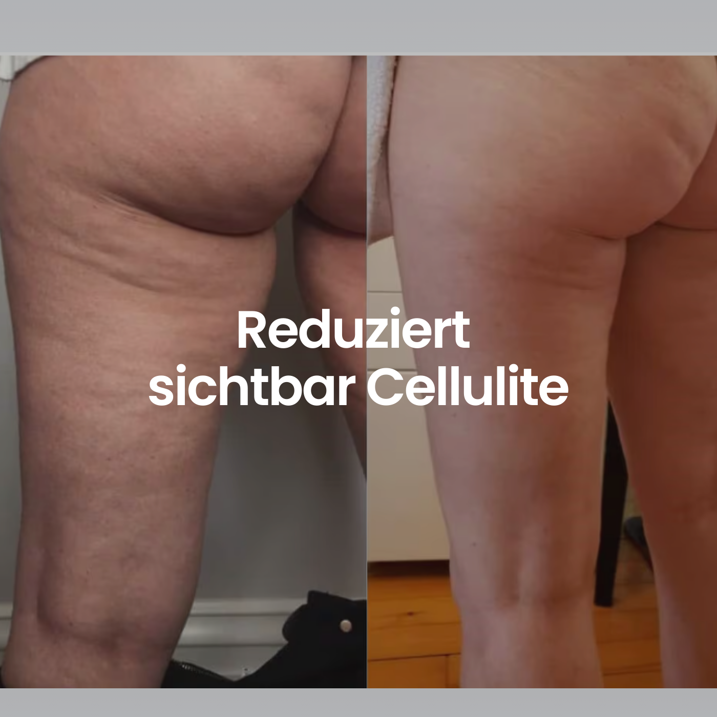 COREEX CelluFlex™ 3D-Kompressionsleggings (Cellulite)