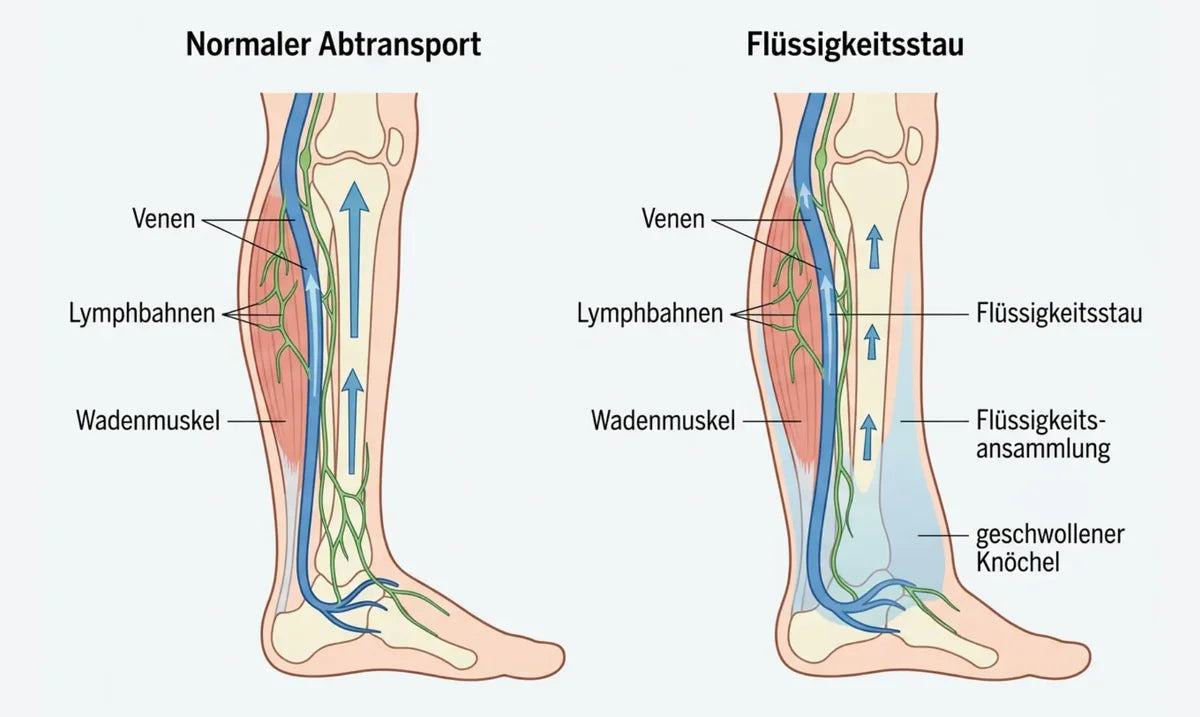 Illustration: Mein Enkel ist Gefäßarzt, und er kannte den Grund, den mir zehn Jahre niemand nannte
