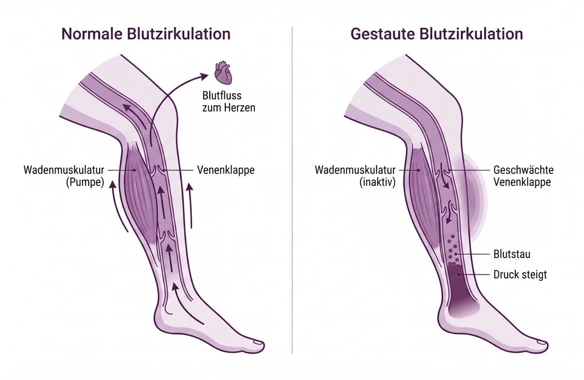 Illustration: In deiner Wade sitzt eine Pumpe. Bei den meisten Frauen läuft sie im Leerlauf